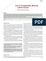 Management of Congenitally Missing Lateral Incisor: Case Report