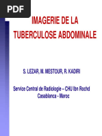 RX de La TBC Abdominale 2