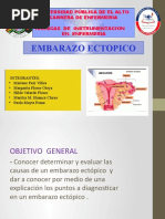 Embarazo Ectopico