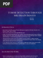 Tumor Detection Through Mri Brain Images: Rohit Arya 20MCS1009