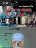 Radiologia de Craneo