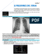 Patologías Frecuentes Del Tórax