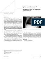 Un Niño de 2 Años Con Un Proceso Pulmonar Agudo: Ual Es Su Iagnostico