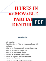 Failures in Removable Partial Denture