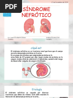 Síndrome Nefrótico