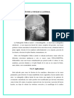 Técnica Cefálica Lateral