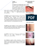 Lesiones Elementales Primarias de La Piel