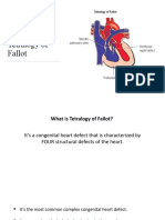 Tetralogy of Fallot