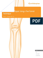 Meniscal Root Repair Using A Two-Tunnel Technique: Smith&nephew