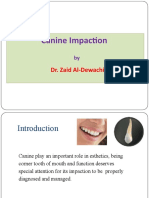 د.زيد الديوه جي Canine impaction-1 (Muhadharaty)