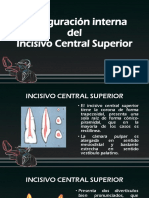 Incisivo Central Superior