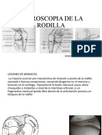 Artroscopia de La Rodilla