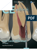 Ebook: Root Canal Obturation