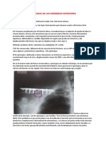 Fracturas de Los Miembros Superiores