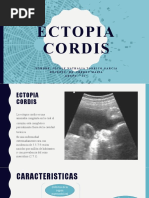 Ectopia Cordis