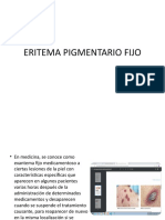 Eritema Pigmentario Fijo