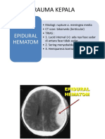 Trauma Kepala