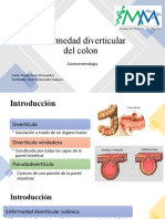 Enfermedad Diverticular Del Colon