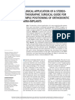 Clinical Application of A Stereolithographic Surgical Guide For Simple Positioning of Orthodontic Mini-Implants.