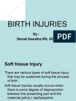 Birth Injuries: By: Murad Sawalha RN, MSN