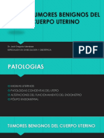 Tumores Benignos Del Cuerpo Uterino