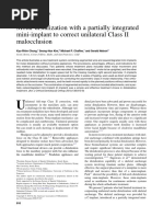 Molar Distalization With A Partially Integrated Mini-Implant To Correct Unilateral Class II Malocclusion