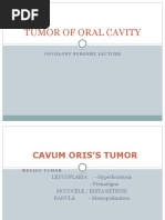 Cavum Oris's Tumor