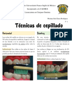 Técnicas de Cepillado