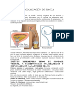 Colocación de Sonda Vesical