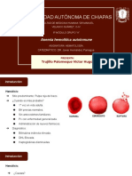 Anemia Hemolítica Autoinmune