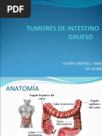 Tumoresdeintestinogruesohenrihaimnp61358 120504145336 Phpapp01