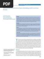 Noncavernous Arteriovenous Shunts Mimicking Carotid Cavernous Fistulae