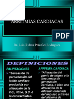 Arritmias Cardiacas