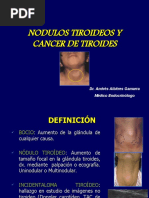 Ca de Tiroides