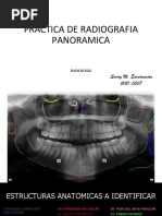 Practica de Radiografia Panoramica