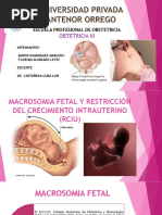 Macrosomia Fetal