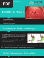 Faringitis Por ERGE