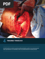 4 Trauma Toracico