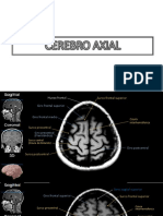 Cortes Cerebro PDF