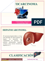 Hepatocarcinoma Diapo