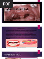 Candidiasis Oral