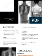 Escoliosis 2021