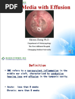 Otitis Media With Effusion: Shixun Zhong PH.D