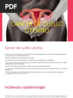 Cancer de Cuello Uterino