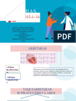 Ekg Arritmias