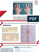 Esclerosis Sistemica