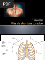 Vias de Abordaje Toracico