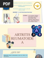 Artritis Reumatoidea-Teoria