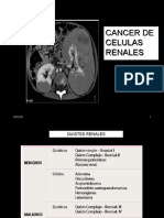 10 Cancer Renal