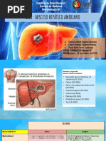 Absceso Hepático Amebiano